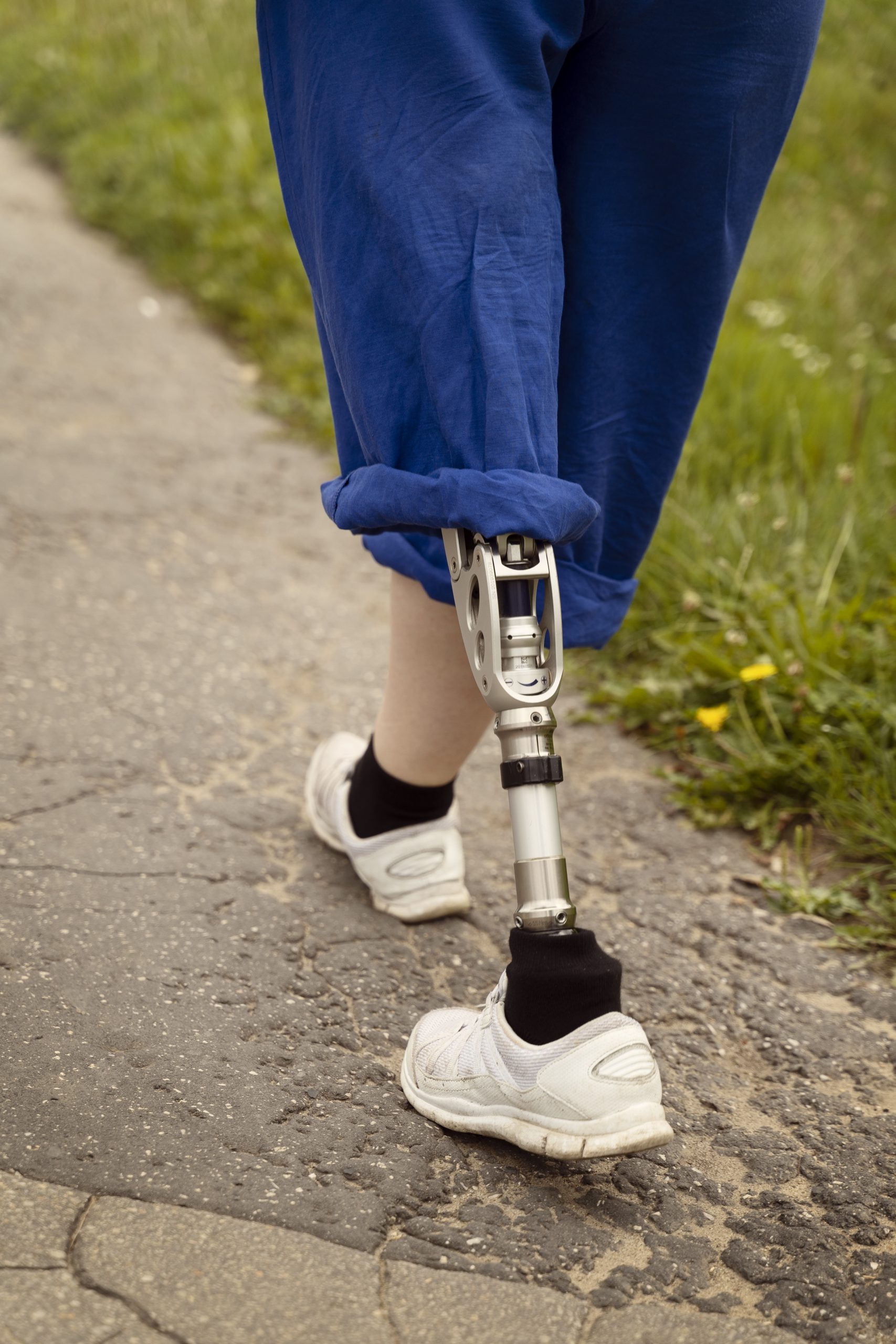 une femme qui marche avec sa prothèse de pied et mollet